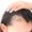 Low Cortisol Cause Hair Loss