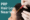 PRP Hair Loss Near Me