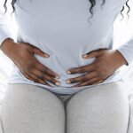 Uterine Fibroids and Hair Loss