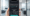 MCAN Hair Graft Calculator