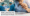 Does Surgery Cause Hair Loss