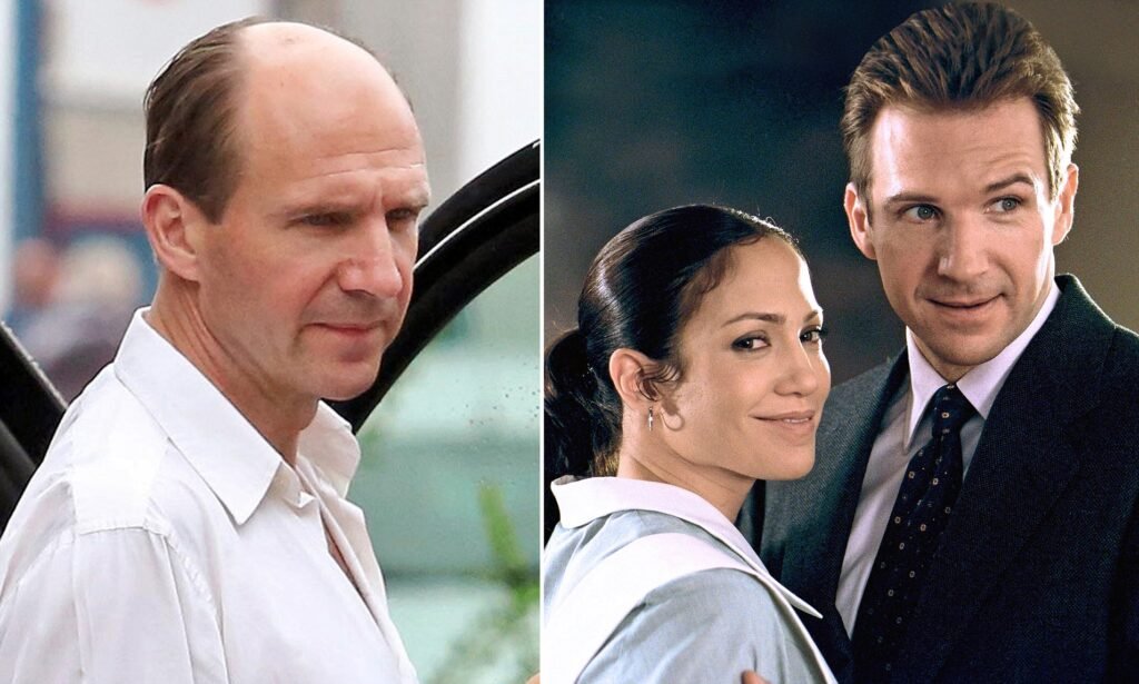Ralph Fiennes Hair Loss