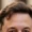 Can Too Much Protein Cause Hair Loss