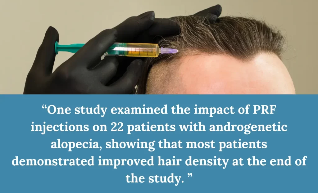 PRF for Hair Loss