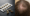 Antibiotics and Hair Loss
