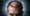Can Syphilis Cause Hair Loss