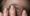 Fragile Nails and Hair Loss