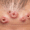 Folliculitis and Hair Loss