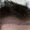 Hair Transplant Process