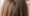 How Many Hairs on a Human Head
