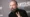 Paul Mitchell Hair Loss Lawsuit