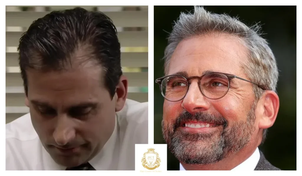 Steve Carell Hair Loss