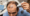 Can Hair Gel Cause Hair Loss