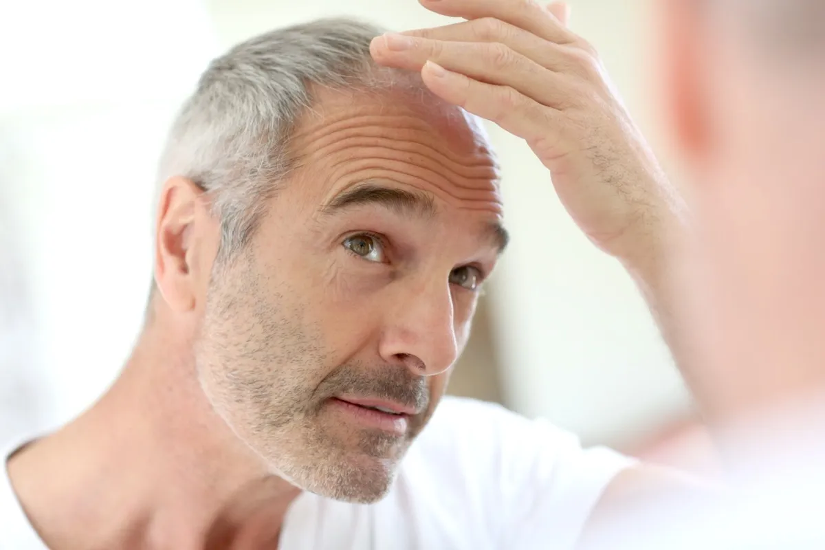 Why Does Surgery Cause Hair Loss