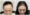 Hair Transplant Cost for Females in Pakistan