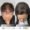 Hair Transplant Cost for Females in Pakistan