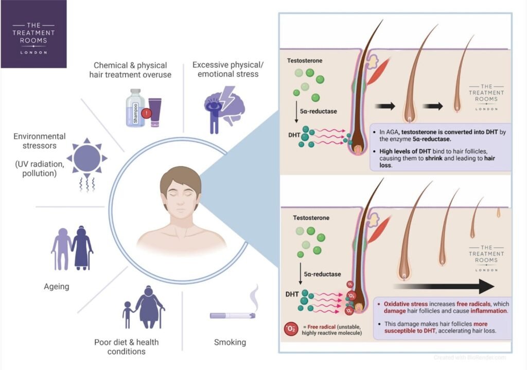 Does Exercise Reduce Hair Loss