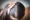 Hair Loss and Depo Provera
