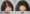 Female Hair Transplant in Islamabad