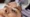 How Much is an Eyebrow Transplant