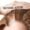 Hair Transplant for Female Pattern Baldness