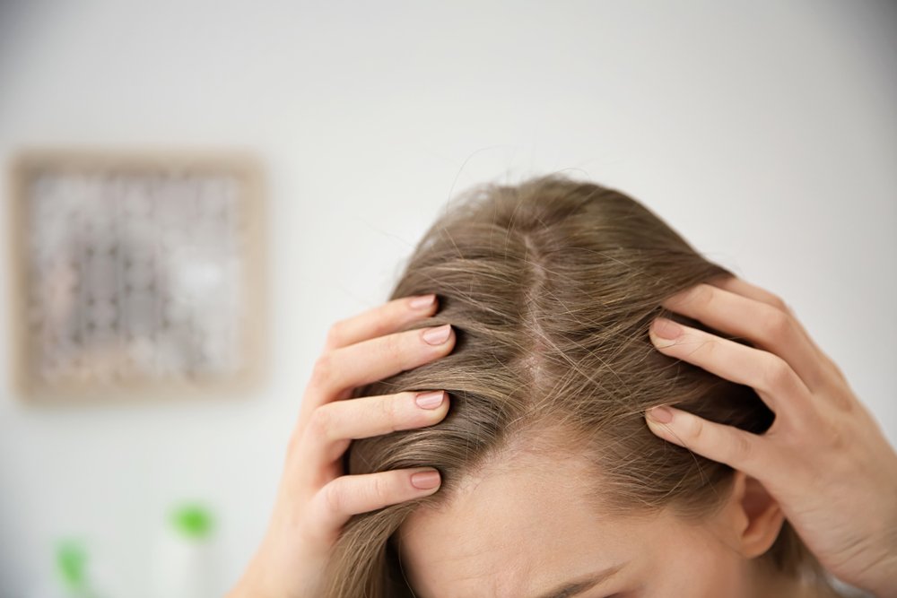Methamphetamine Hair Loss