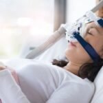 Sleep Apnea and Hair Loss