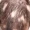 can alopecia areata be reversed