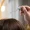 Alopecia areata management