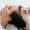 Miscarriage and Hair Loss