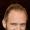 Ralph Fiennes Hair Loss