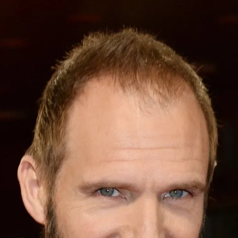 Ralph Fiennes Hair Loss