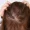 Hair Loss Practitioner