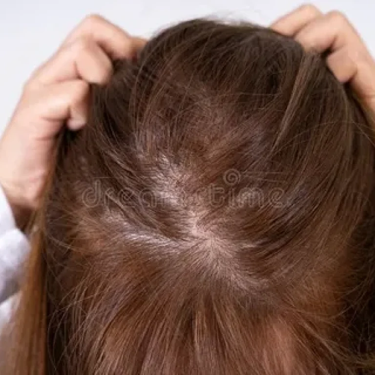 Hair Loss Practitioner