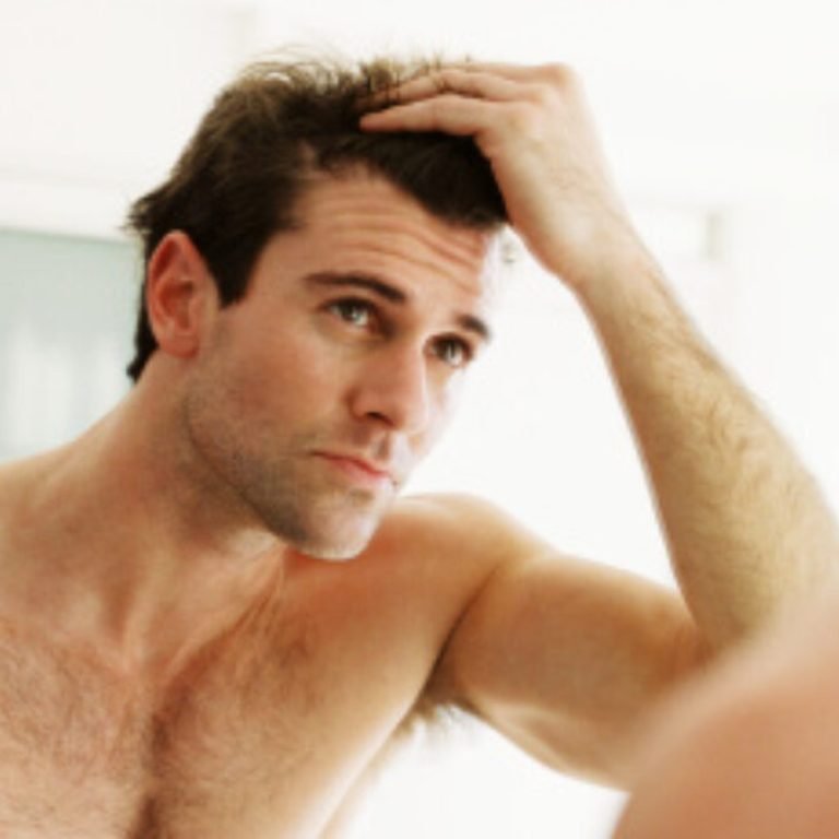 Winstrol and Hair Loss