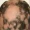 alopecia areata how to diagnose alopecia topical