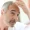 Why Does Surgery Cause Hair Loss