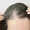 does thin hair grow back