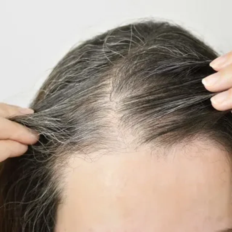 does thin hair grow back