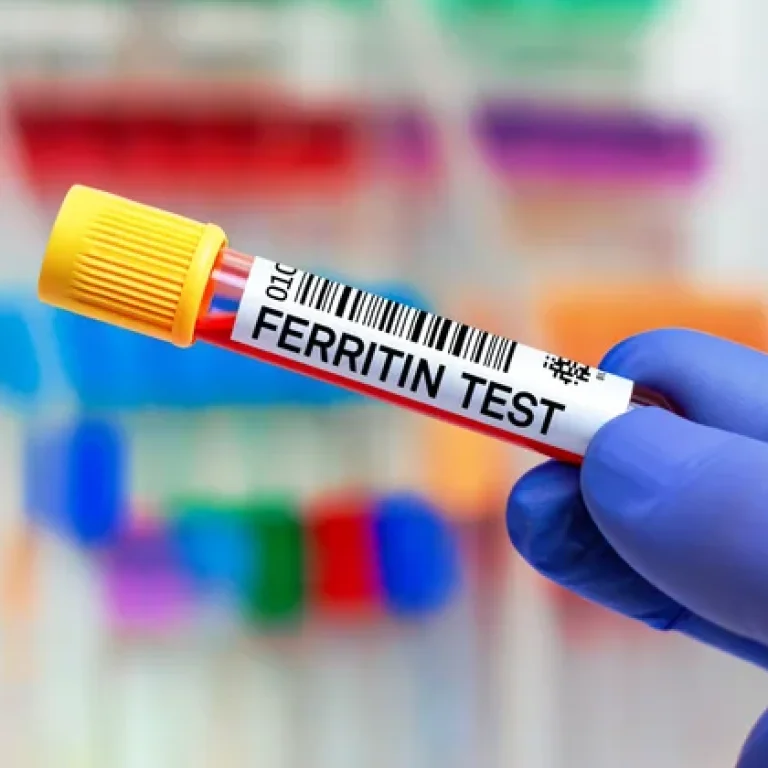 Can High Ferritin Cause Hair Loss