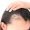 Low Cortisol Cause Hair Loss