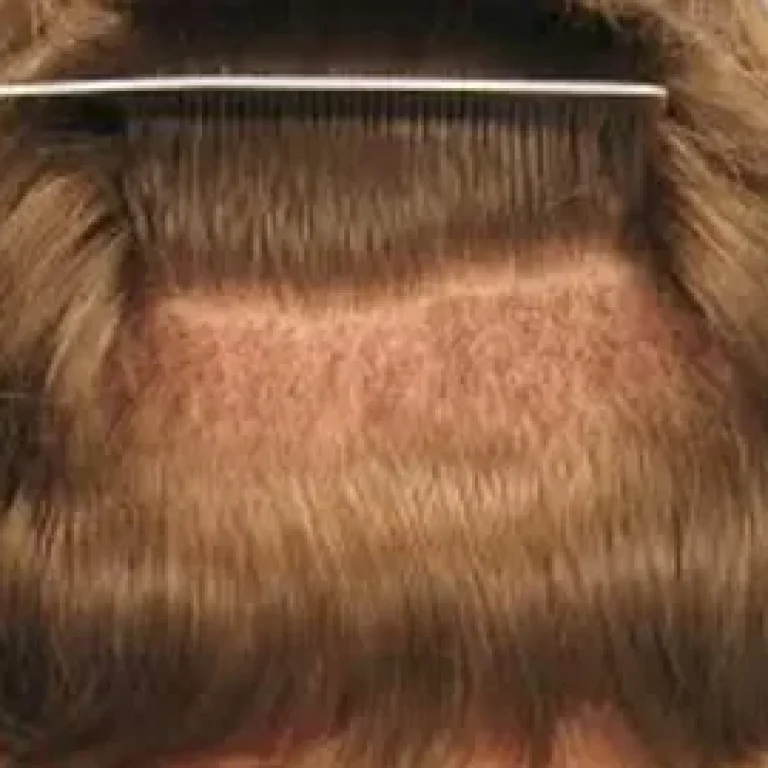 when will hair cloning be available to the public