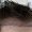 Hair Transplant Process