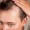how to stop receding hairline