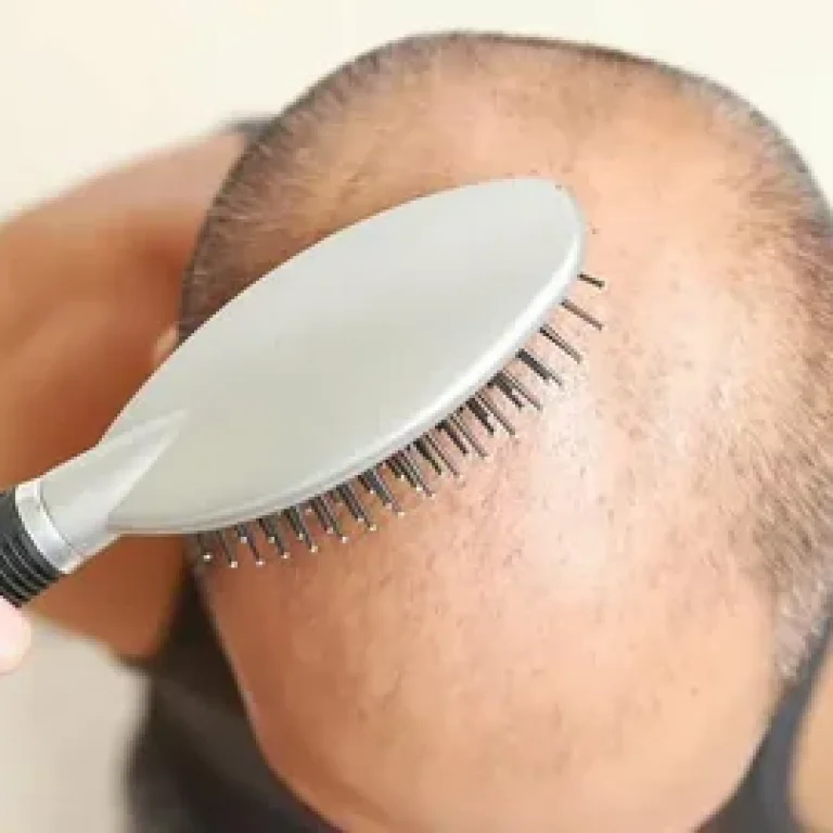 just for men hair loss