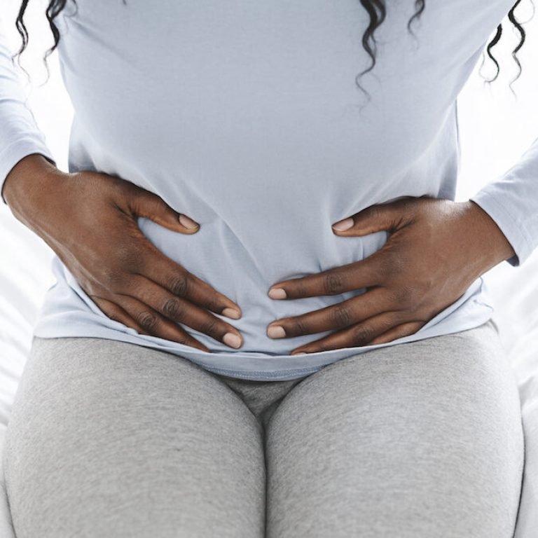 Uterine Fibroids and Hair Loss