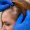 how do you get tested for alopecia